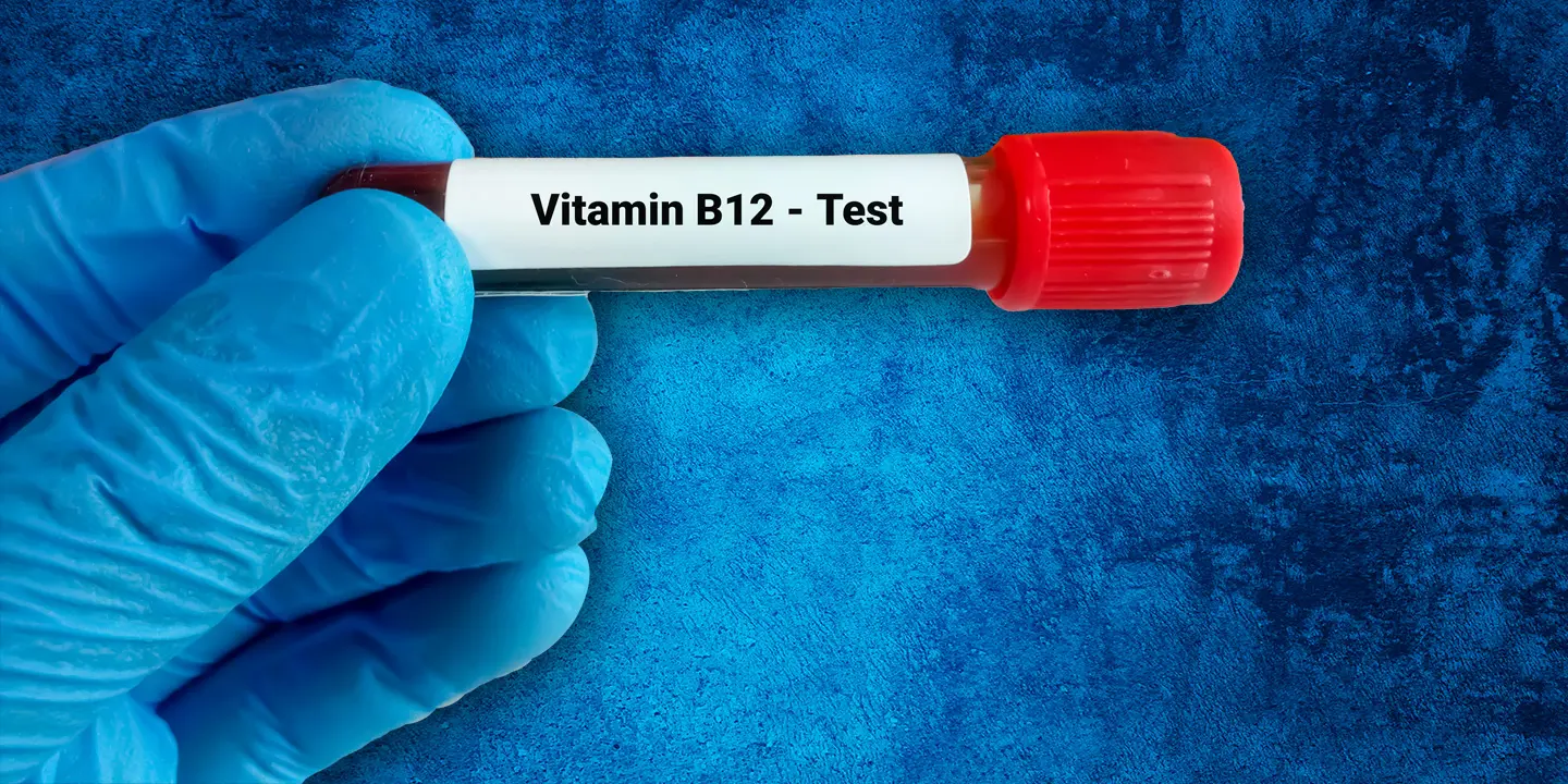 Vitamin B12 Tests