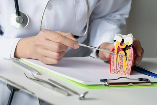 Restore and Refresh Your Smile in Brisbane with Root Canal Treatment and Porcelain Veneers